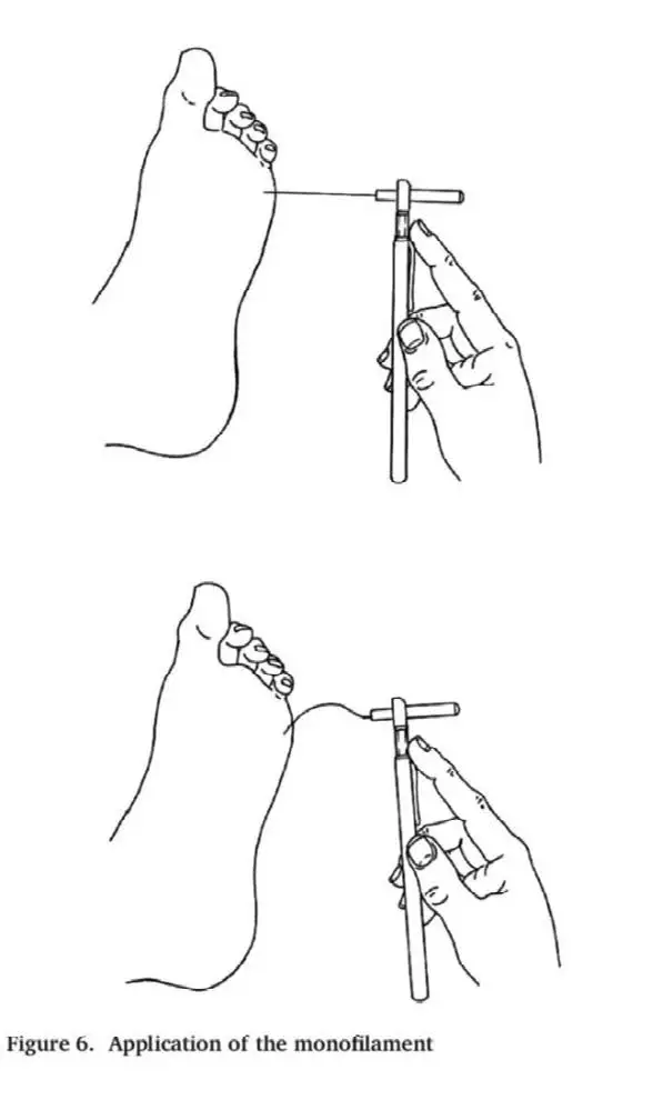 Appendix-12-Monofilament-Application
